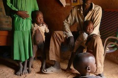 Sguardo angosciato, un padre non riesce a nascondere, pur se con dignità, la sua preoccupazione per la salute del suo ultimo figlio che tiene tra le braccia, villaggio Mouja, Niger 2019